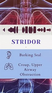 Different sound you may hear during lung Auscultation by stethoscope 🩺. . . #lungdisease #pathology #stethoscope #viral #viralreels #trandingaudio #tranding #mbbs #mbbsstudent #doctor #nursing #nursingstudent #doctors #cardiology #neetpg #fmge #neet #medical #medicalstudents #medicalknowledge #medicos | medicalmania007