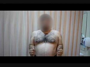 Pre- And Postoperative Outcome In Massive Rotator Cuff Tear Correction  • Video • MEDtube.net