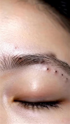 Clean Eating Guide | Inspiring Millions to Eat Clean on Instagram: "LINK IN BIO @cleaneatguide ⚡BFCM FLASH SALE⚡ 50 % OFF! GlowTea™ Pore Stick — a detoxifying green tea + eggplant mud stick that purifies pores, balances oil and reveals your real glow Deep‑cleansing, pore‑tightening and gentle enough for daily use. Swipe it on and watch blackheads vanish. This 50 % off BFCM deal is melting away fast! 💫🔥 Get Yours Now!"