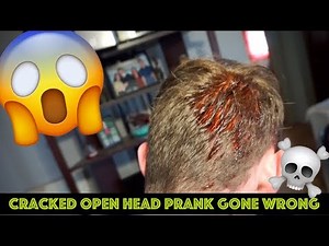CRACKED OPEN HEAD PRANK GONE WRONG