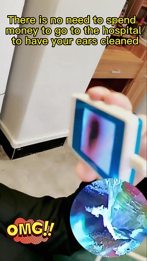 We spend a lot of money going to the hospital for ear health every year. With this visual ear pick, we can maintain the safety of our ears at home #earpickingcamera #visualearpicking #earhealth #healthy #safety #icesnowstore