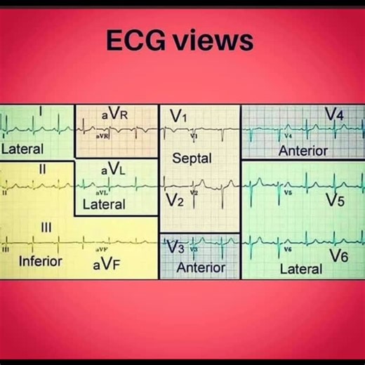 Cardiology on Instagram: "ECG STMI how to find #cardiology #ecg #cardiologist #cardiac #heartattack #cardio #cardiologia #cardio #echocardiography"