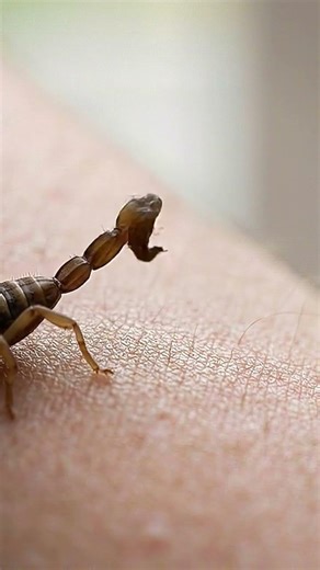 🦂 Scorpion Sting Inside Human Skin | Ultra-Realistic 3D Venom Visualization