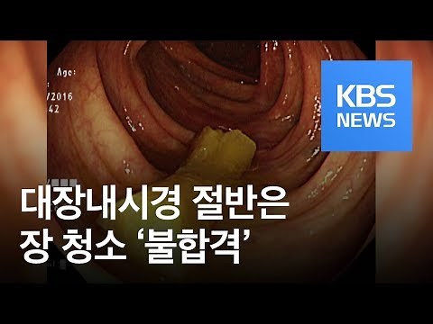 대장내시경 절반은 장 청소 ‘불합격’ / KBS뉴스(News)