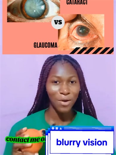 #glaucoma #cataract #eyecare #tiktokghana🇬🇭 #fyp
