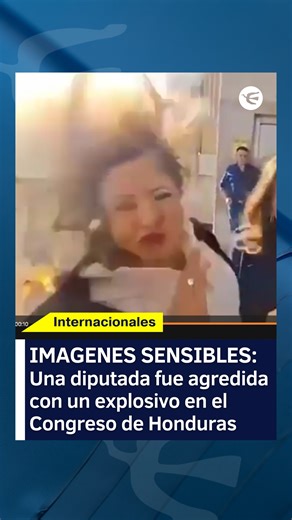Perfil.com on Instagram: "🔴Una diputada fue agredida con un explosivo en el Congreso de Honduras 🇭🇳Gladis Aurora López, fue agredida con un explosivo en el Congreso hondureño este jueves, en lo que se presume que fue un ataque dirigido a un compañero suyo, Tomás Zambrano, que sin embargo resultó ileso. 👉Por el incidente se apuntó al presidente del Congreso, quien fue declarado "traidor a la patria". 🩺La explosión le quemó parte del cabello y le produjo heridas superficiales en el cuello y l