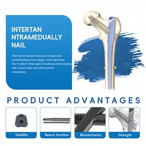 [Hot Item] Medical Supply Orthopedic Implant Titanium Femoral Intertan Interlocking Nail