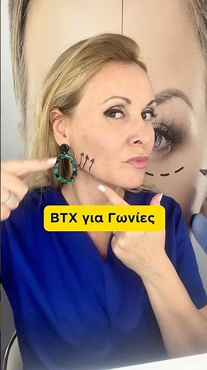 Γωνίες Προσώπου με Botox ￼ #botox