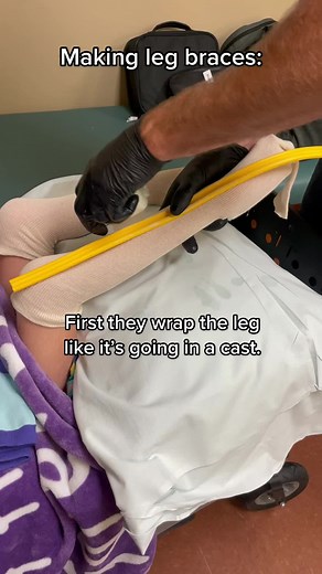 #howitsmade #MakingTheCut #frostarmy #fyp #medical #cast #legbraces #AFO