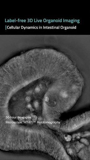 Cellular Dynamics in Intestinal Organoid