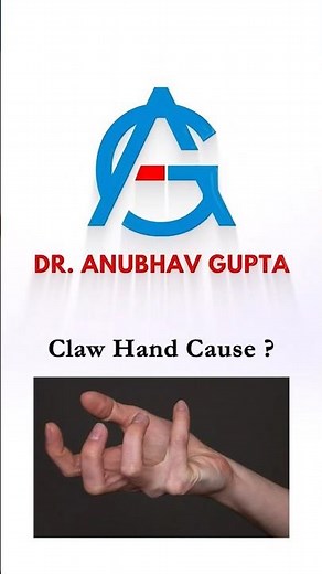 What Causes Claw Hand? | Ulnar Nerve Injury & Intrinsic Muscle Paralysis Explained
