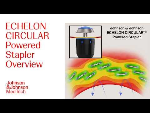 ECHELON CIRCULAR Powered Stapler: Improving Patient Outcomes | J&J MedTech