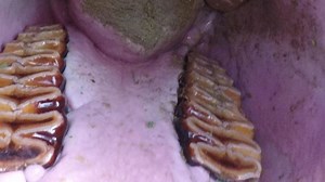 A Peek inside Jabu's mouth! Elephants go through 6 sets of teeth that push in from behind (not underneath) and fracture off in pieces at the front. First sets are replaced more rapidlly than later sets due to rapid growth while young. The last set is fully in place by about 48 yrs and last 20yrs. #standwithjabu www.withelephants.org www.gofundme.com/standwithjabu #livingwithelephants | Living With Elephants Foundation
