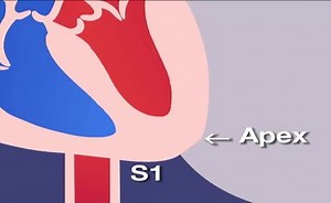 The Anatomy and Physiology of Heart Sounds: Heart Sounds