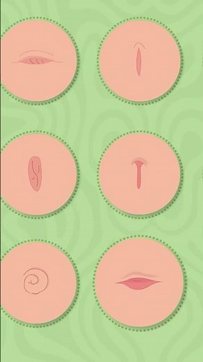 Most Common Types of Belly Buttons #shorts