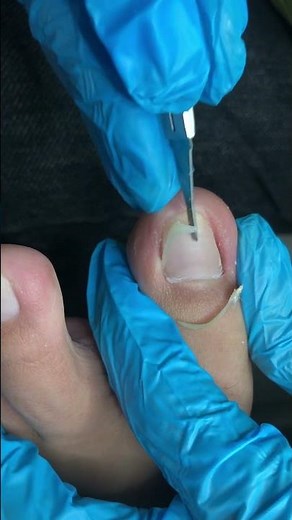Cut Off The Long, Thin Inlay Nails! #nails #pedicure