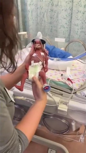 26 Weeks premature baby critical condition please pray🙏😢 #baby #premature #26weeksbaby #babyshorts