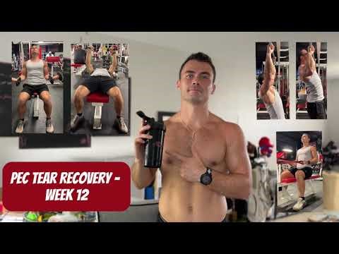 Pec Tear Recovery - Week 12 | CHEST EXERCISES, done with PT, addressing my fatness, & next steps!