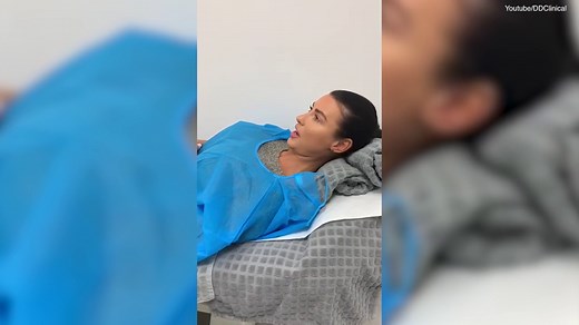 Model Alice Goodwin goes through laser vaginal 'rejuvenation'