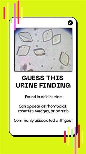 Guess this Urine Finding #4 | Urinalysis Review