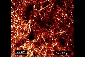 File:Lab-on-a-brain-Implantable-micro-optical-fluidic-devices-for-neural-cell-analysis-in-vivo-srep06721-s3.ogv - Wikimedia Commons