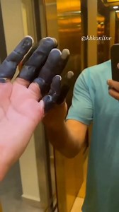 Frostbite. A condition in which skin and the tissue just below the skin freeze. Frostbite mostly affects small, exposed body parts such as fingers and toes. Your frostbitten skin turns black because your skin cells die after freezing. Your skin might form a hard, black covering (carapace) that falls off on its own. If it doesn't, a healthcare provider will remove it surgically. #kbkfoundation | Kbkonline | Facebook