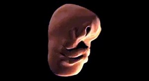 This is how the human face develops in the womb