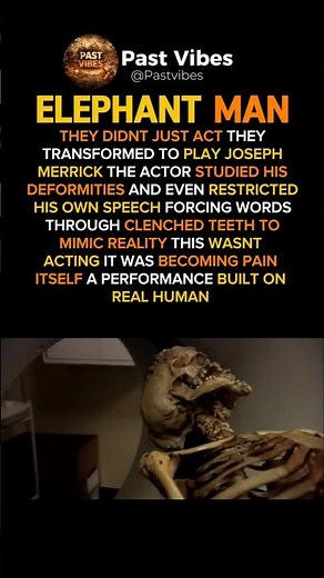 This wasn’t acting… it was real pain brought to life 😳