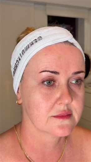 CONNECT YOUR SKIN on Instagram: "✨ Before & After⚡️The Power of the Facial Muscle Workout with Dermotechnology ✨ This transformation was performed on Magdalena, one of our precious partners and certified trainers of Dermotechnology, during her two-day Master Trainer session in Miami. Magdalena naturally has beautiful plumpness and skin density, a wonderful foundation. In her case, the goal was not to add volume, but to lift, tone, and strengthen the deep muscular structure of the face, the true 