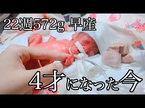 22週572gで生まれた赤ちゃん 「4歳になった今」 第二子の妊娠で気づいたこと（切迫流産・切迫早産・早産・出産）