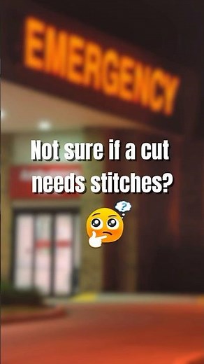 Does This Cut Need Stitches? 3 Signs to Know!