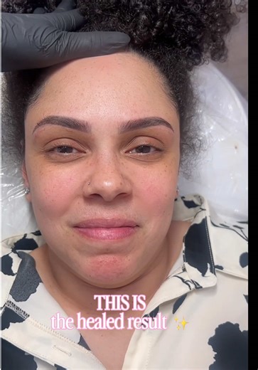 Transforming Eyebrows: Healing Stages Explained