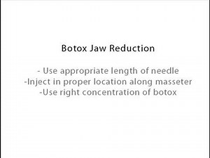 Learn About Jaw Reduction With Botox