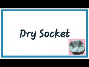 Dry Socket (Alveolar Osteitis) - Important Notes | Oral Pathology | Dental Occlusion