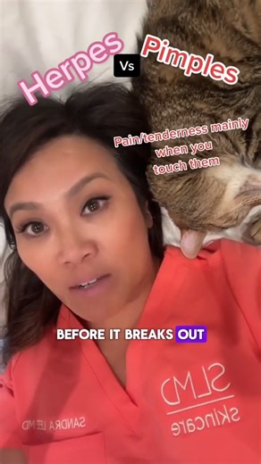 Most of us actually carry the herpes virus - some of us just don’t break out.⁠ ⁠ #stitch with @claudiaravioli on TT!⁠ ⁠ #drpimplepopper #skincare #dermatology #herpes #pimples #acne | Dr Sandra Lee aka drpimplepopper