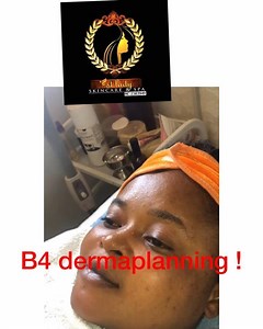 DO YOU NEED A BABY FLAWLESS FACE ? DO YOU NEED AN INSTANT GLOW! • • DERMAPLANNING IS FOR YOU! TAKE OFF DEAD EPIDERMIS OFF YOUR FACE WITH ULTRASONIC SCRUBBER & DERMPLANNING + LED MASK! PROCEDURE COST 10,000 Book a session! Whatsapp 2347059900676 or DM Fast way for a glowing face ! | 1stlady Skin Care & Spa | Facebook
