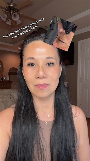 Understanding Safe Injection Techniques for Tox