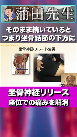 坐骨神経の走行を変えて症状を根治 #Short, #セミナー, #セラピスト, #リハビリ, #神経痛, #リハビリ, #解剖学, #柔道整復師, #治療