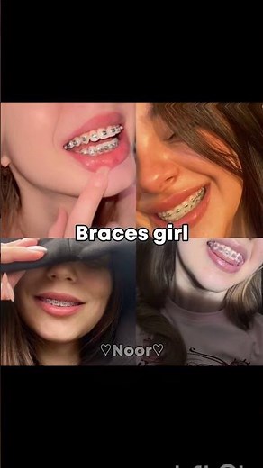 glasses,braces,dimples or bangs girl??🎀🌷 #asethicedits #noor #fypシ