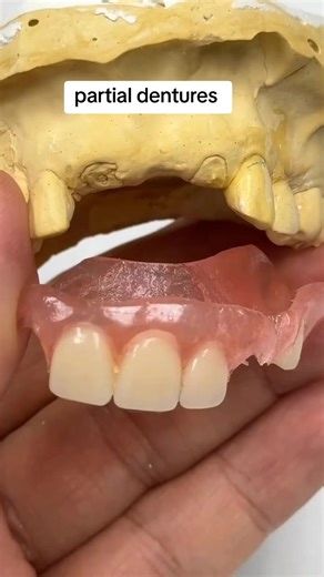 Understanding Partial Dentures for Enhanced Smiles