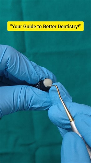 Hex Sirius on Instagram: "Tips you should always remember!!!! . . . #drhexsirius #dental #trending #mds #bds #mbbs #composite #endodontic #surgery #dentalhacks #basics #tipsandtricks"