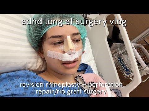 i’m back :p revision rhinoplasty surgery vlog in turkey