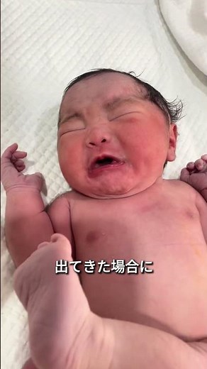 赤ちゃんの足が曲がる症状