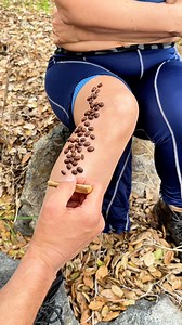 Ranger rips her pants off to save woman's leg from bug infestation! 😱 | Amelia G