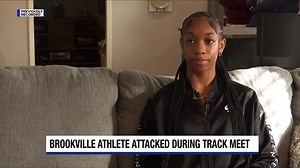 High school track star seriously injured, hit by rival runner's relay baton