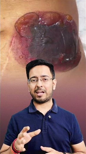 DON'T SKIP THIS IF YOU'RE PLANNING FOR A CRYOLIPOLYSIS PROCEDURE! #cosmeticsurgery #fatfreezing