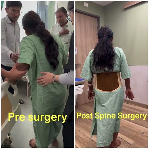 Endoscopic Spine treatment : New life to patients #pune #backpain #neckpain #bones #neurology