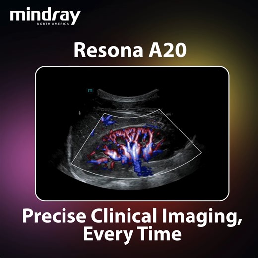The power to see, in your hands. The Resona A20 transducer lineup is designed to deliver high-performance imaging, comfort, and versatility. Optimized to work with our proprietary Acoustic Intelligence Technology (AIT), each transducer automatically analyzes and enhances acoustic signals for consistently clear images. Learn More >>>https://bit.ly/4rSx3qK #UltraSolution #Radiology #MindrayUltrasound #UltrasoundInnovation | Mindray North America