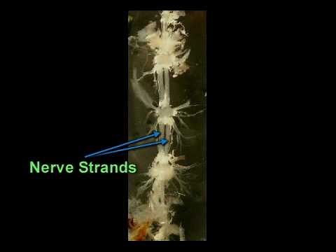 Cockroach dissection - Nervous system