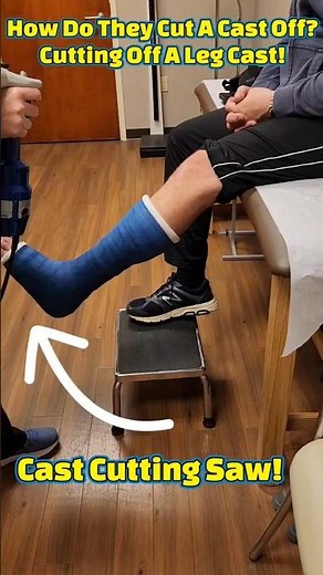 How To Cut A Cast Off? Removing My Half Leg Cast: The Process Revealed! 🏨🪚😱